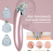Blackhead Remover Facial Cleaner